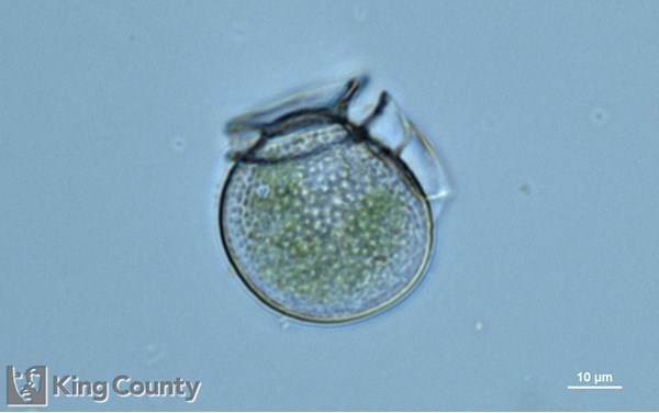 Photo of Dinophysis parva